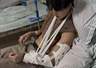 一级运动员兼职景区NPC掰手腕遭游客致伤 涉事游客失联仅付2万医疗费