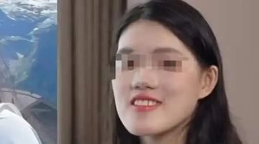 武汉一女孩正颌手术被反向操作 当地卫健委介入调查