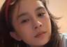赵樱子自曝把脸部填充都融掉了，只剩假体鼻子无法复原