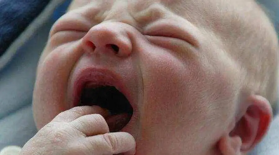 新生儿头尖如笋,奶奶直呼“怪物”“傻子”,医生:瞎说,这娃是报恩的,而且天生聪明