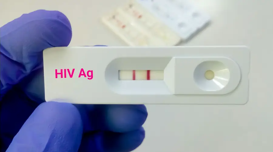 艾滋病检测结果不告知配偶？早有共识，勿以偏概全 ｜ 九派时评
