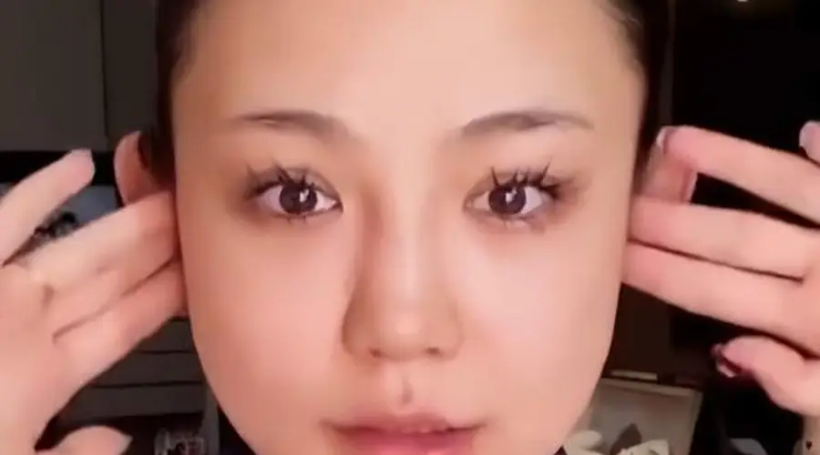 网红婉儿医美翻车，自嘲“关了美颜像孙猴子”