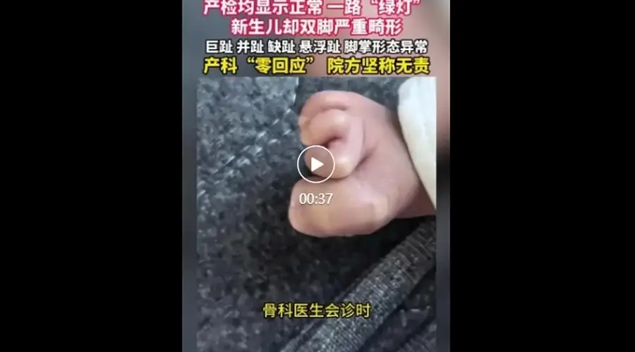 珠海新生儿产检未查出四肢畸形 院方称属医学盲区无责任