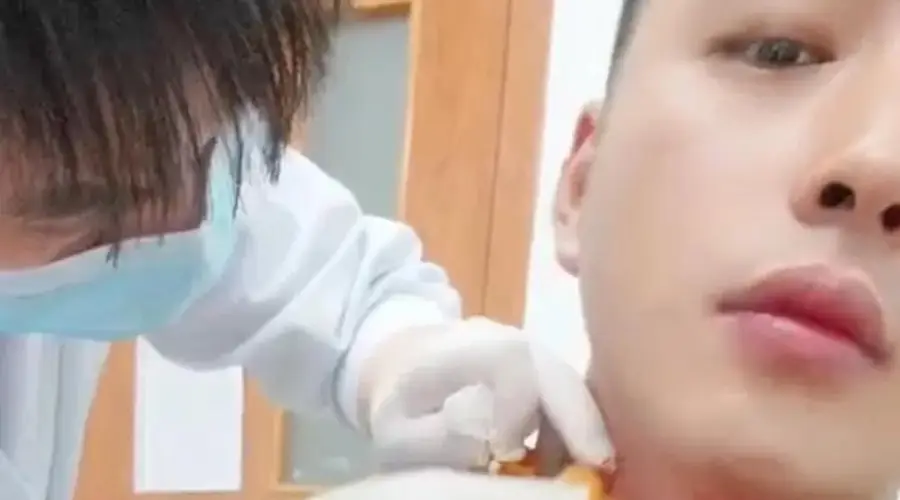男子被蚊子叮咬脖子后血流1小时 量达400毫升 当事人发声 接诊医生称首次遇此类情况